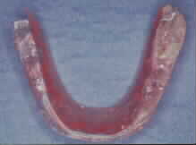 yokosplint.JPG (3544 �o�C�g)